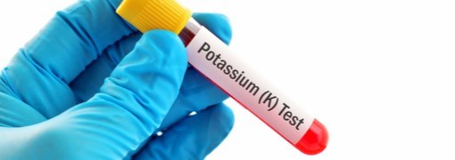 בדיקת רמת אשלגן (Potassium) - תמונה